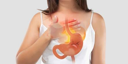 8 Ways to Get Rid of Heartburn